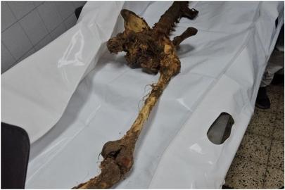 İşgal rejiminin Gazze’de yaptığı soykırımın kanıtları