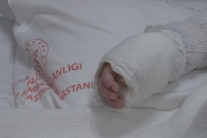 İstanbul'da bebeğin üzerine kaynar su döküldü: Vücudunun yüzde 27'si yandı