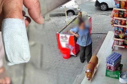 Pitbull saldırısından parmağını kaybetti: Yetişmeselerdi ölecektim